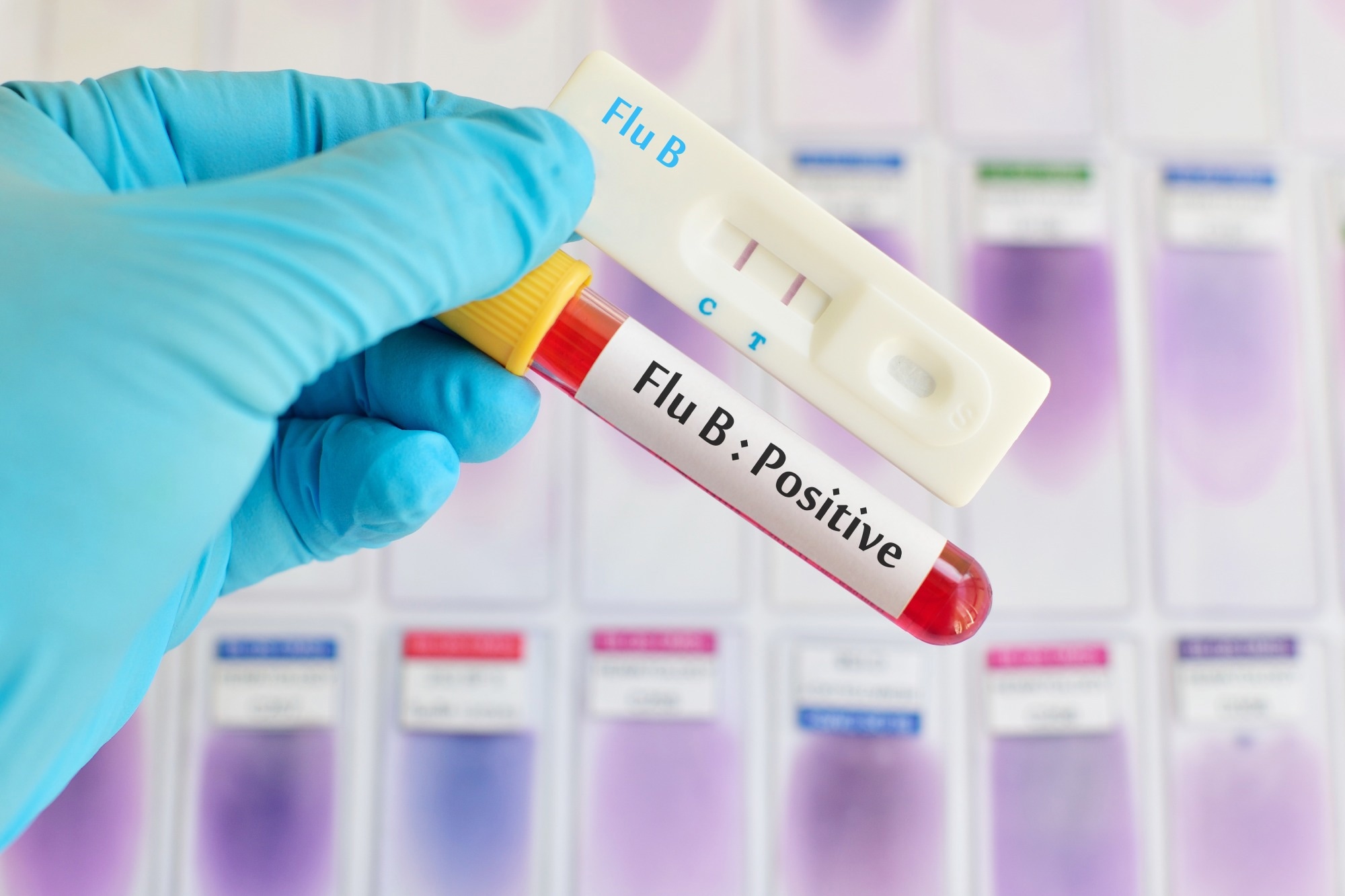 Influenza B Virus Detection with QD-based Fluorescence Biosensors